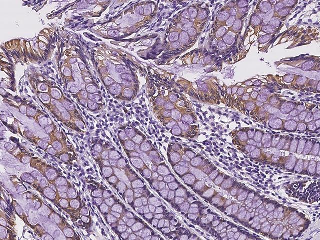 SLC35A2 / UGT Antibody - Immunochemical staining of human SLC35A2 in human rectum with rabbit polyclonal antibody at 1:500 dilution, formalin-fixed paraffin embedded sections.