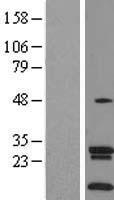 SLC35A4 Protein - Western validation with an anti-DDK antibody * L: Control HEK293 lysate R: Over-expression lysate