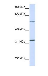 SLC35A5 Antibody - Fetal muscle lysate. Antibody concentration: 1.0 ug/ml. Gel concentration: 12%.  This image was taken for the unconjugated form of this product. Other forms have not been tested.