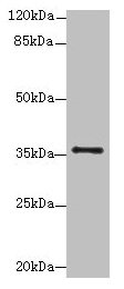 SLC35B1 / UGTREL1 Antibody - Western blot All lanes: SLC35B1 antibody at 4µg/ml + HL60 whole cell lysate Secondary Goat polyclonal to rabbit IgG at 1/10000 dilution Predicted band size: 36, 40 kDa Observed band size: 36 kDa