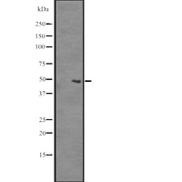 SLC35B2 Antibody - Western blot analysis of SLC35B2 expression in A375 cells line lysates. The lane on the left is treated with the antigen-specific peptide.