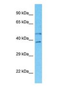 SLC35B2 Antibody - Western blot of SLC35B2 Antibody with human 786-0 Whole Cell lysate.  This image was taken for the unconjugated form of this product. Other forms have not been tested.