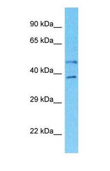 SLC35B2 Antibody - Western blot of SLC35B2 Antibody with human 786-0 Whole Cell lysate.  This image was taken for the unconjugated form of this product. Other forms have not been tested.
