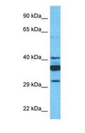 SLC35C1 Antibody - Western blot of SLC35C1 Antibody with human 721_B Whole Cell lysate.  This image was taken for the unconjugated form of this product. Other forms have not been tested.