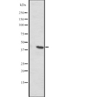 SLC35C2 Antibody - Western blot analysis of SLC35C2 expression in mouse liver tissue lysates. The lane on the left is treated with the antigen-specific peptide.
