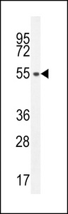 SLC35E2 Antibody - S35E2 Antibody western blot of HL-60 cell line lysates (35 ug/lane). The S35E2 antibody detected the S35E2 protein (arrow).
