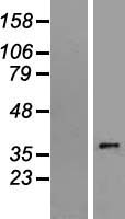 SLC35E3 Protein - Western validation with an anti-DDK antibody * L: Control HEK293 lysate R: Over-expression lysate