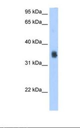 SLC35F2 Antibody - Transfected 293T cell lysate. Antibody concentration: 2.5 ug/ml. Gel concentration: 12%.  This image was taken for the unconjugated form of this product. Other forms have not been tested.