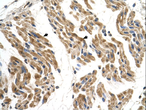 SLC35F2 Antibody - SLC35F2 antibody SLC35F2(solute carrier family 35, member F2) Antibody was used in IHC to stain formalin-fixed, paraffin-embedded human muscle.  This image was taken for the unconjugated form of this product. Other forms have not been tested.
