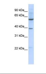 SLC35F3 Antibody - 721_B cell lysate. Antibody concentration: 1.0 ug/ml. Gel concentration: 12%.  This image was taken for the unconjugated form of this product. Other forms have not been tested.