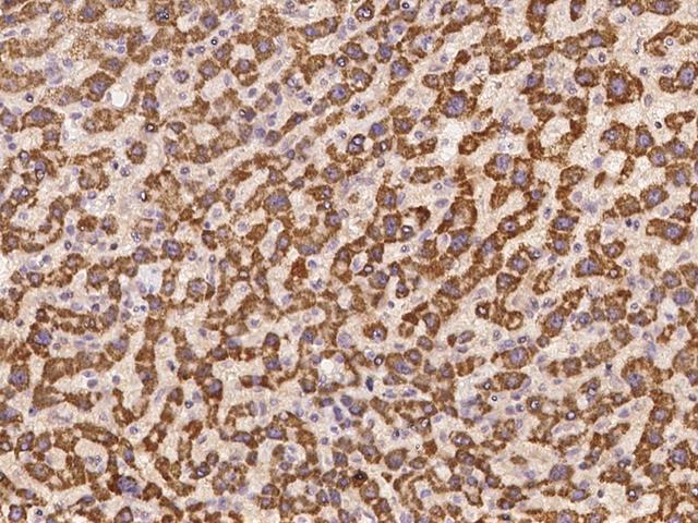 SLC35F4 Antibody - Immunochemical staining of human SLC35F4 in human liver with rabbit polyclonal antibody at 1:100 dilution, formalin-fixed paraffin embedded sections.