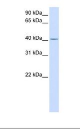 SLC35F6 Antibody - Fetal lung lysate. Antibody concentration: 1.0 ug/ml. Gel concentration: 12%.  This image was taken for the unconjugated form of this product. Other forms have not been tested.