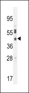 SLC35F6 Antibody - CB018 Antibody western blot of U251 cell line lysates (35 ug/lane). The CB018 antibody detected the CB018 protein (arrow).