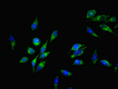 SLC35F6 Antibody - Immunofluorescent analysis of Hela cells using SLC35F6 Antibody at dilution of 1:100 and Alexa Fluor 488-congugated AffiniPure Goat Anti-Rabbit IgG(H+L)
