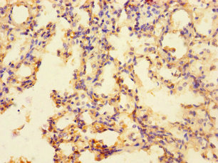 SLC35F6 Antibody - Immunohistochemistry of paraffin-embedded human lung tissue using SLC35F6 Antibody at dilution of 1:100