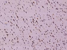 SLC35F6 Antibody - Immunochemical staining of human C2orf18 in human brain with rabbit polyclonal antibody at 1:100 dilution, formalin-fixed paraffin embedded sections.