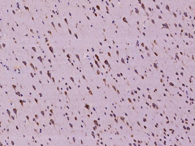 SLC35F6 Antibody - Immunochemical staining of human C2orf18 in human brain with rabbit polyclonal antibody at 1:100 dilution, formalin-fixed paraffin embedded sections.