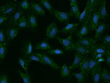 SLC35G2 Antibody - Immunofluorescence staining of SLC35G2 in U2OS cells. Cells were fixed with 4% PFA, permeabilzed with 0.1% Triton X-100 in PBS, blocked with 10% serum, and incubated with rabbit anti-Human SLC35G2 polyclonal antibody (dilution ratio 1:100) at 4°C overnight. Then cells were stained with the Alexa Fluor 488-conjugated Goat Anti-rabbit IgG secondary antibody (green) and counterstained with DAPI (blue). Positive staining was localized to Cytoplasm.