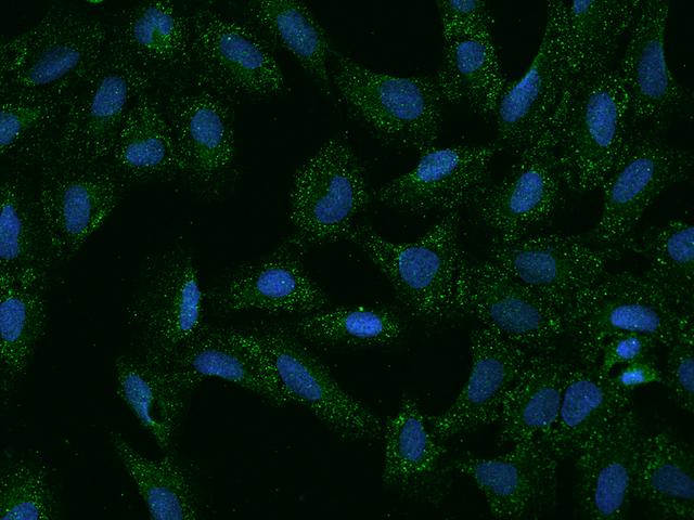 SLC35G2 Antibody - Immunofluorescence staining of SLC35G2 in U2OS cells. Cells were fixed with 4% PFA, permeabilzed with 0.1% Triton X-100 in PBS, blocked with 10% serum, and incubated with rabbit anti-Human SLC35G2 polyclonal antibody (dilution ratio 1:100) at 4°C overnight. Then cells were stained with the Alexa Fluor 488-conjugated Goat Anti-rabbit IgG secondary antibody (green) and counterstained with DAPI (blue). Positive staining was localized to Cytoplasm.