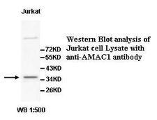 SLC35G3 Antibody