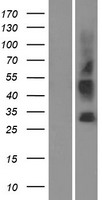 SLC35G3 Protein - Western validation with an anti-DDK antibody * L: Control HEK293 lysate R: Over-expression lysate
