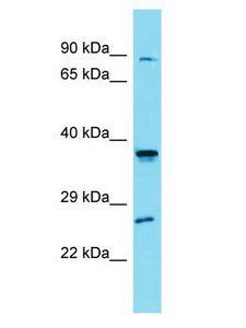 SLC35G4 Antibody - SLC35G4 antibody Western Blot of HepG2. Antibody dilution: 1 ug/ml.  This image was taken for the unconjugated form of this product. Other forms have not been tested.