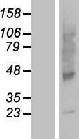 SLC35G5 / AMAC1L2 Protein - Western validation with an anti-DDK antibody * L: Control HEK293 lysate R: Over-expression lysate