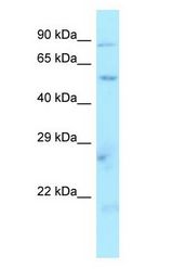 SLC36A1 Antibody - SLC36A1 antibody Western Blot of Jurkat.  This image was taken for the unconjugated form of this product. Other forms have not been tested.