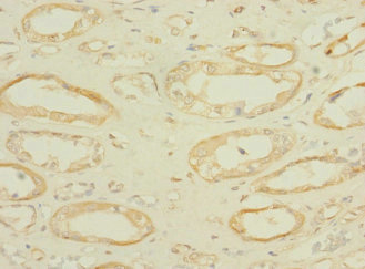 SLC36A2 Antibody - Immunohistochemistry of paraffin-embedded human kidney tissue using SLC36A2 Antibody at dilution of 1:100