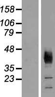 SLC36A2 Protein - Western validation with an anti-DDK antibody * L: Control HEK293 lysate R: Over-expression lysate