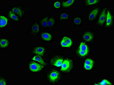 SLC36A3 Antibody - Immunofluorescent analysis of MCF-7 cells using SLC36A3 Antibody at dilution of 1:100 and Alexa Fluor 488-congugated AffiniPure Goat Anti-Rabbit IgG(H+L)