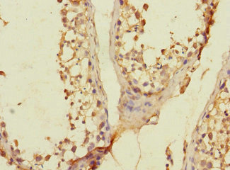 SLC36A3 Antibody - Immunohistochemistry of paraffin-embedded human testis tissue using SLC36A3 Antibody at dilution of 1:100