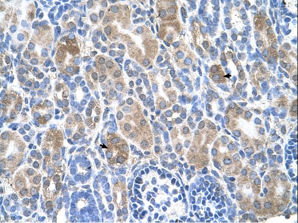 SLC36A3 Antibody - SLC36A3 antibody ARP44155_T100-NP_861439-SLC36A3(solute carrier family 36 (proton/amino acid symporter), member 3) Antibody was used in IHC to stain formalin-fixed, paraffin-embedded human kidney.  This image was taken for the unconjugated form of this product. Other forms have not been tested.