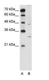 SLC36A3 Antibody - A: Marker, B: Jurkat Cell Lysate.  This image was taken for the unconjugated form of this product. Other forms have not been tested.