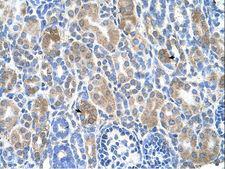 SLC36A3 Antibody - SLC36A3 antibody ARP44155_T100-NP_861439-SLC36A3(solute carrier family 36 (proton/amino acid symporter), member 3) Antibody was used in IHC to stain formalin-fixed, paraffin-embedded human kidney.  This image was taken for the unconjugated form of this product. Other forms have not been tested.