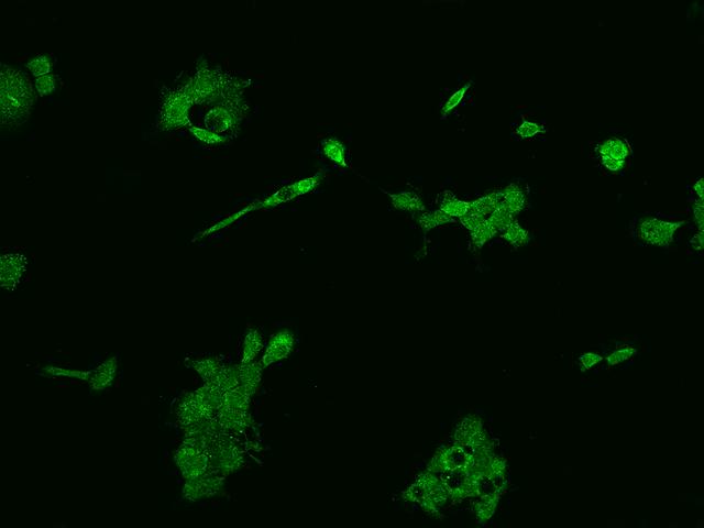 SLC36A4 Antibody - Immunofluorescence staining of SLC36A4 in A431 cells. Cells were fixed with 4% PFA, permeabilzed with 0.1% Triton X-100 in PBS, blocked with 10% serum, and incubated with rabbit anti-Human SLC36A4 polyclonal antibody (dilution ratio 1:200) at 4°C overnight. Then cells were stained with the Alexa Fluor 488-conjugated Goat Anti-rabbit IgG secondary antibody (green). Positive staining was localized to Cytoplasm.