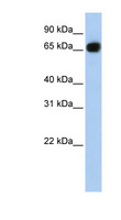 SLC37A1 Antibody - SLC37A1 antibody Western blot of Fetal Brain lysate. This image was taken for the unconjugated form of this product. Other forms have not been tested.
