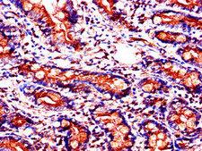 SLC37A2 Antibody - Immunohistochemistry of paraffin-embedded human small intestine tissue using SLC37A2 Antibody at dilution of 1:100