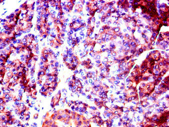 SLC37A2 Antibody - Immunohistochemistry of paraffin-embedded human pancreatic tissue using SLC37A2 Antibody at dilution of 1:100