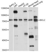 SLC37A2 Antibody - Western blot analysis of extracts of various cell lines, using SLC37A2 antibody at 1:3000 dilution. The secondary antibody used was an HRP Goat Anti-Rabbit IgG (H+L) at 1:10000 dilution. Lysates were loaded 25ug per lane and 3% nonfat dry milk in TBST was used for blocking. An ECL Kit was used for detection and the exposure time was 30s.