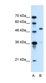 SLC37A3 Antibody - SLC37A3 antibody ARP44064_P050-NP_996996-SLC37A3(solute carrier family 37 (glycerol-3-phosphate transporter), member 3) Antibody Western blot of HepG2 cell lysate.  This image was taken for the unconjugated form of this product. Other forms have not been tested.