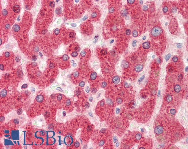 SLC37A4 / G6PT Antibody - Human, Liver: Formalin-Fixed Paraffin-Embedded (FFPE).  This image was taken for the unconjugated form of this product. Other forms have not been tested.