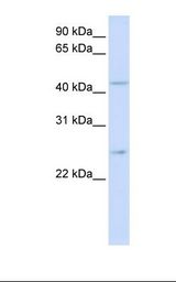 SLC37A4 / G6PT Antibody - Fetal brain lysate. Antibody concentration: 1.0 ug/ml. Gel concentration: 12%.  This image was taken for the unconjugated form of this product. Other forms have not been tested.