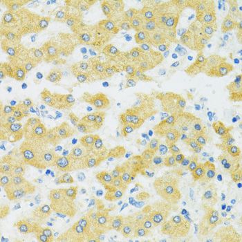SLC37A4 / G6PT Antibody - Immunohistochemistry of paraffin-embedded human liver using SLC37A4 antibody at dilution of 1:100 (40x lens).