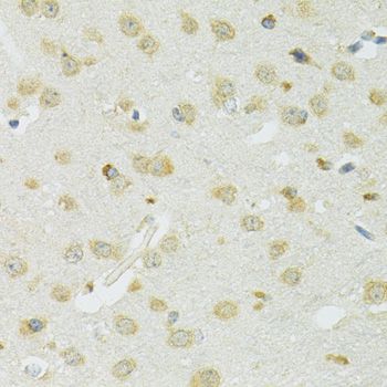 SLC37A4 / G6PT Antibody - Immunohistochemistry of paraffin-embedded mouse brain using SLC37A4 antibody at dilution of 1:100 (40x lens).