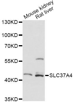 SLC37A4 / G6PT Antibody - Western blot analysis of extracts of various cell lines, using SLC37A4 antibody at 1:3000 dilution. The secondary antibody used was an HRP Goat Anti-Rabbit IgG (H+L) at 1:10000 dilution. Lysates were loaded 25ug per lane and 3% nonfat dry milk in TBST was used for blocking. An ECL Kit was used for detection and the exposure time was 90s.