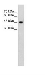 SLC38A1 / NaT2 Antibody - HepG2 Cell Lysate.  This image was taken for the unconjugated form of this product. Other forms have not been tested.