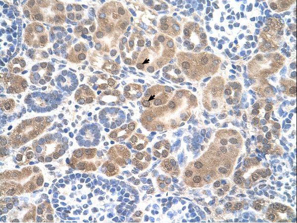 SLC38A1 / NaT2 Antibody - SLC38A1 antibody ARP43810_T100-NP_001070952-SLC38A1(solute carrier family 38, member 1) Antibody was used in IHC to stain formalin-fixed, paraffin-embedded human kidney.  This image was taken for the unconjugated form of this product. Other forms have not been tested.