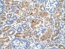 SLC38A1 / NaT2 Antibody - SLC38A1 antibody ARP43810_T100-NP_001070952-SLC38A1(solute carrier family 38, member 1) Antibody was used in IHC to stain formalin-fixed, paraffin-embedded human kidney.  This image was taken for the unconjugated form of this product. Other forms have not been tested.