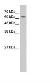 SLC38A1 / NaT2 Antibody - HepG2 Cell Lysate.  This image was taken for the unconjugated form of this product. Other forms have not been tested.